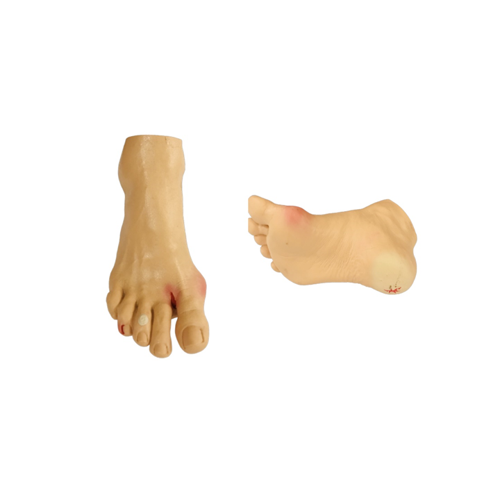 Model Pemeriksaan Kaki Diabetes Image